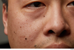 Man Asian Chubby Face Skin Textures